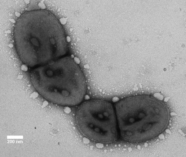 Herpes genitalis: Ik heb herpes genitalis | Thuisarts.nl